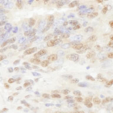 Rabbit anti-PolD3/p66 IHC Antibody, Affinity Purified