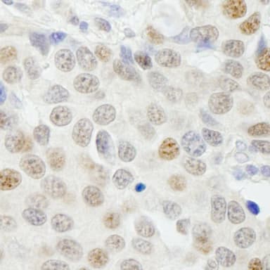 Rabbit anti-GTF3C4/TFIII1C90 IHC Antibody, affinity purified
