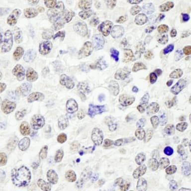 Rabbit anti-CDC25c IHC Antibody, Affinity Purified