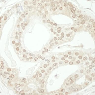 Rabbit anti-ZBTB40 IHC Antibody, Affinity Purified