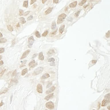 Rabbit anti-PPP1CC IHC Antibody, Affinity Purified