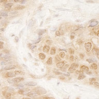 Rabbit anti-MCAK IHC Antibody, Affinity Purified