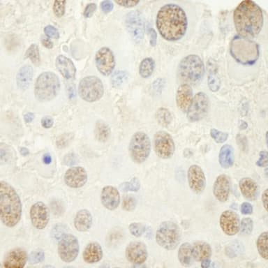 Rabbit anti-NF-YC IHC Antibody, Affinity Purified