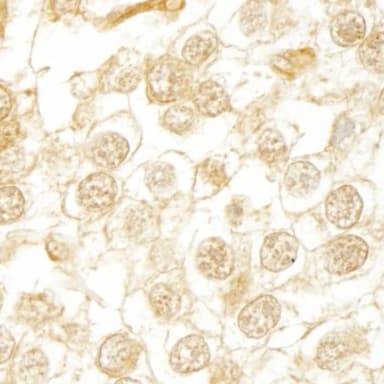 Rabbit anti-WDR20 IHC Antibody, Affinity Purified