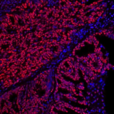 Rabbit anti-SET IHC Antibody, Affinity Purified