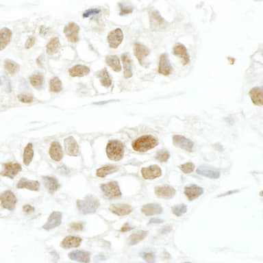 Rabbit anti-TFIIS IHC Antibody, Affinity Purified