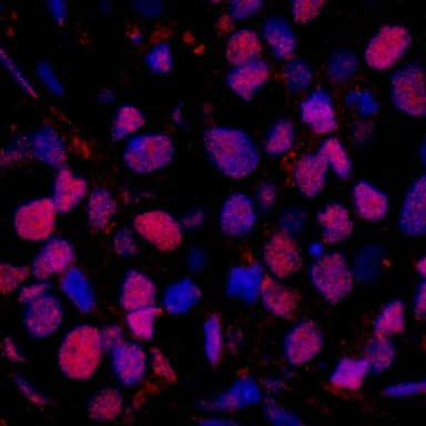 Rabbit anti-RAD23B IHC Antibody, Affinity Purified