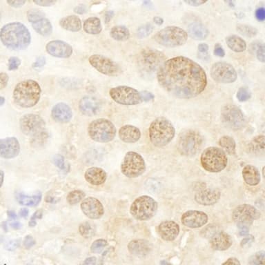 Rabbit anti-Pc2 IHC Antibody, Affinity Purified
