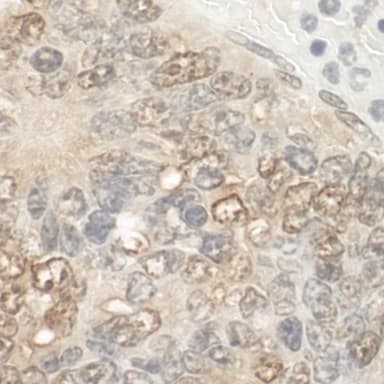 Rabbit anti-ZCCHC11 IHC Antibody, Affinity Purified